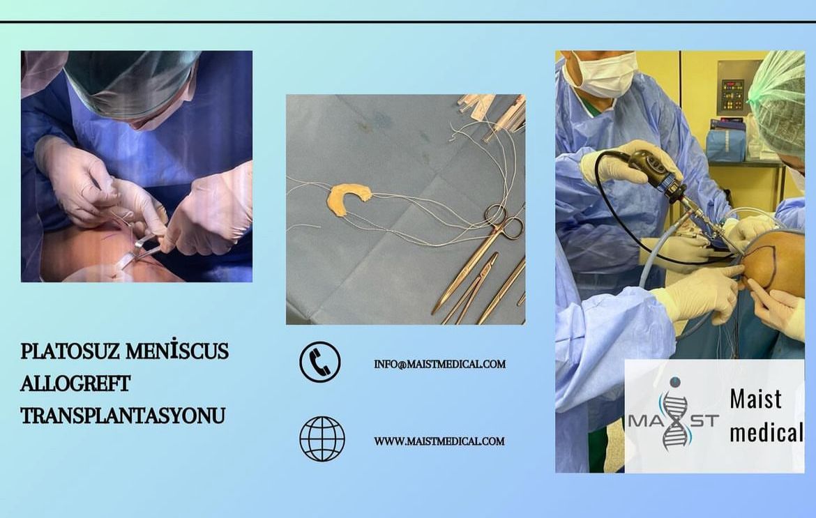 Kullanıcı odaklı    kusursuz    işlevsel